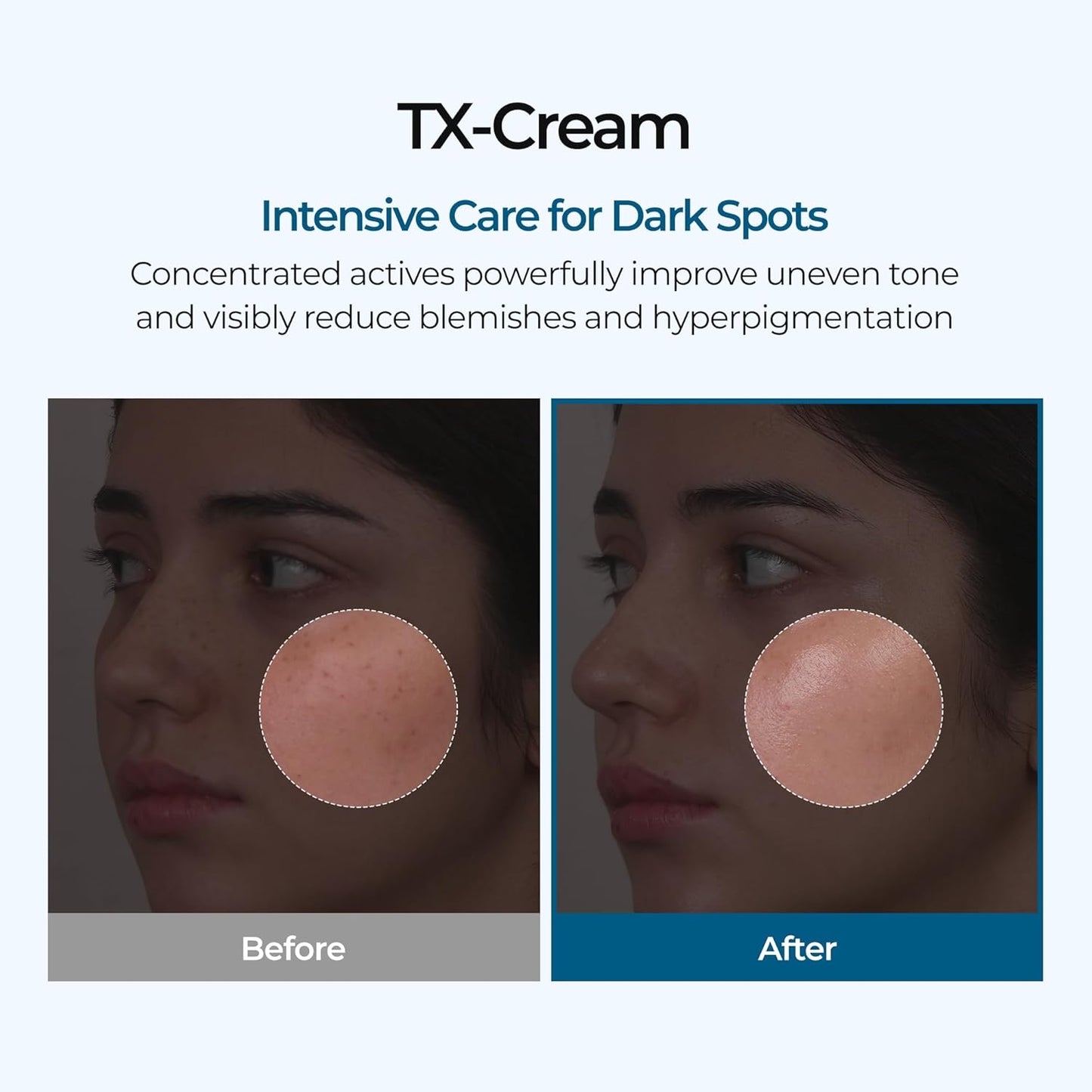 Dr. Melaxin TX-Cream (Tranexamic Acid + Niacinamide 70,000 ppm) 50 ML