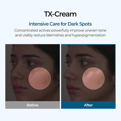 Dr. Melaxin TX-Cream (Tranexamic Acid + Niacinamide 70,000 ppm) 50 ML