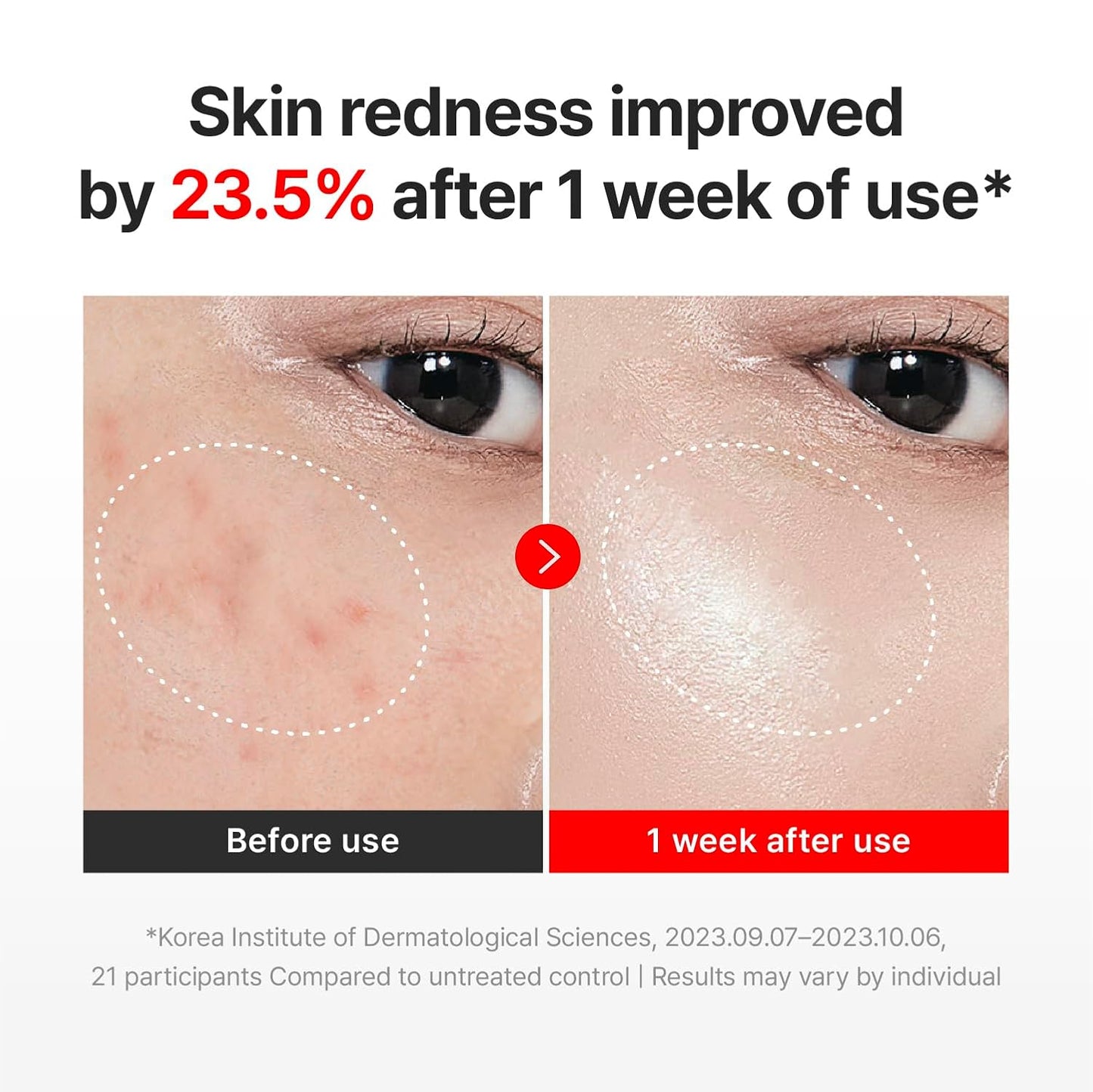 Madeca Cream (Centellian24)