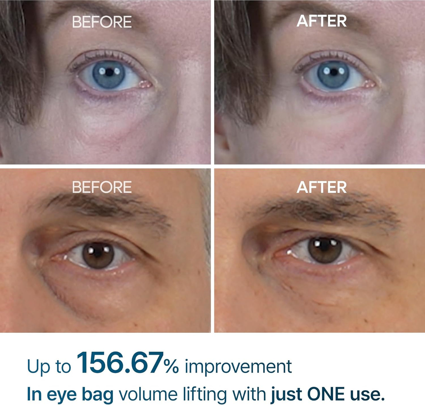 Dr. Melaxin Eyephalt Eyebag Cream – Korean Under Eye Lifting & Anti-Aging Treatment(10 ML)