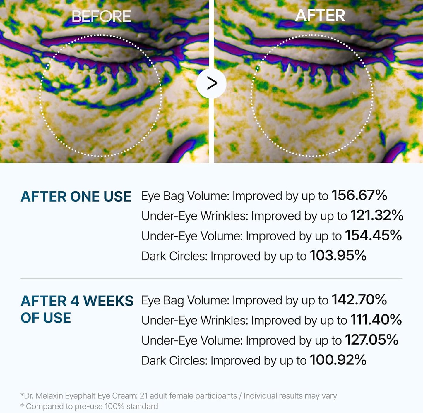 Dr. Melaxin Eyephalt Eyebag Cream – Korean Under Eye Lifting & Anti-Aging Treatment(10 ML)